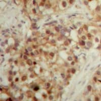 LONP2 / LONP Antibody (C-Terminus)