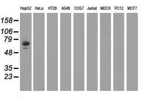 Monoclonal Mouse anti-Human Alpha-Fetoprotein Antibody (clone OTI1E8, IHC, WB)