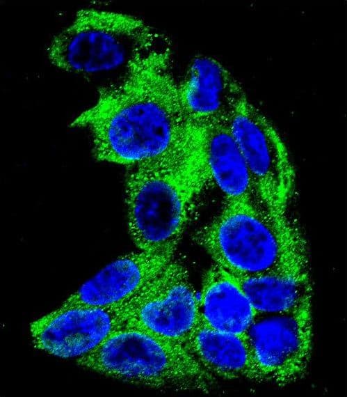 MCAD / ACADM Antibody (aa189-217)