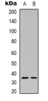 Polyclonal Rabbit anti-Human CASP3 / Caspase 3 Antibody (Internal, IHC, WB)