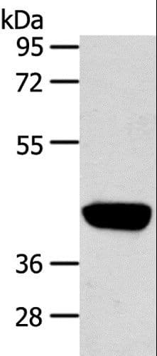 PRSS50 / TSP50 Antibody