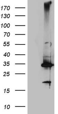 Monoclonal Mouse anti-Human CRP / C-Reactive Protein Antibody (clone OTI7C10, IHC, WB)