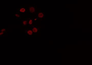 CELF1 / CUGBP1 Antibody