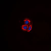 Polyclonal Rabbit anti-Human ACVRL1 Antibody (Internal, IHC, IF, WB)
