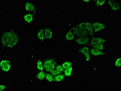 IHC-plus™ Polyclonal Rabbit anti-Human NUDT21 Antibody (IHC)