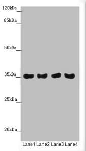 Polyclonal Rabbit anti-Human TOMM34 Antibody (IHC, WB)
