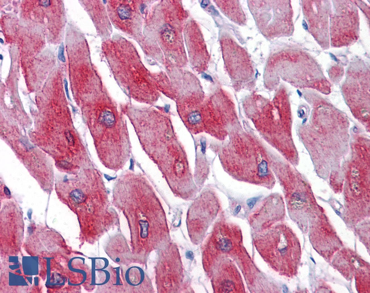 IHC-plus™ Monoclonal Mouse anti-Human ATP2A1 / SERCA1 Antibody (clone 1B11, IHC, IF, WB)