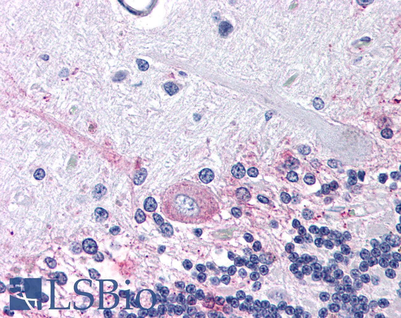 IHC-plus™ Polyclonal Rabbit anti-Human PTGER3 / EP3 Antibody (Cytoplasmic Domain, IHC)