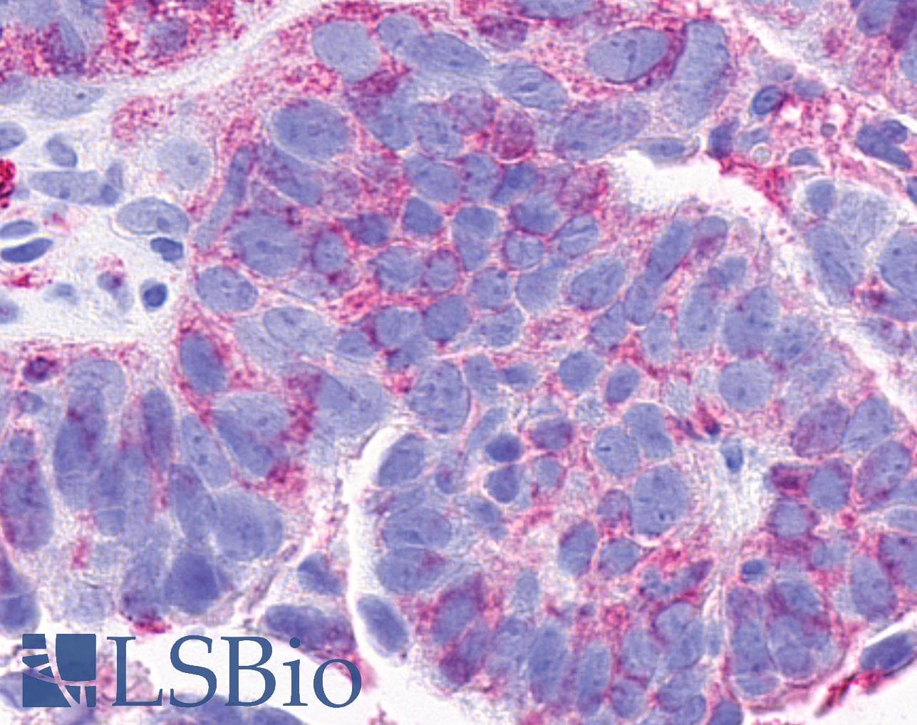 IHC-plus™ CCRL2 Antibody (Cytoplasmic Domain)