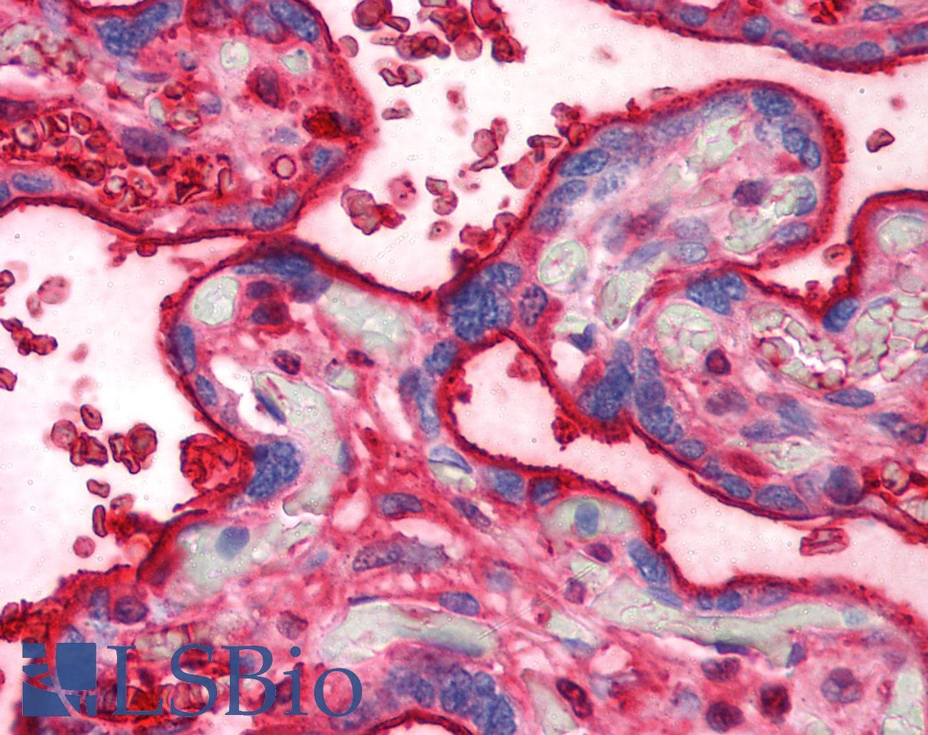 IHC-plus™ TF / Transferrin Antibody (clone HTF-14)