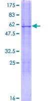 Human CDYL Protein (Recombinant GST)