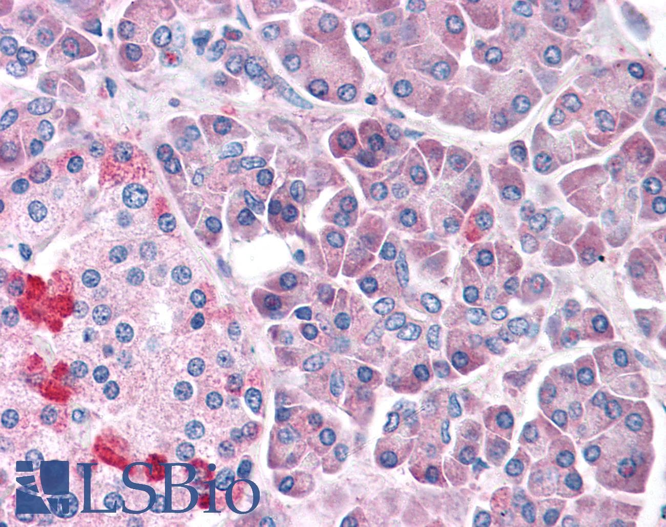 IHC-plus™ LRRN4 / C20orf75 Antibody (Internal)