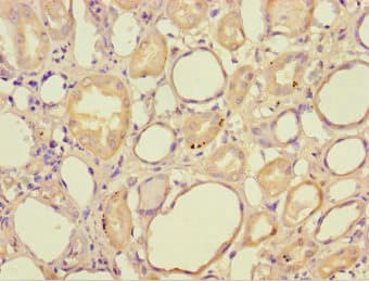 HAGH Antibody
