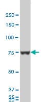 IHC-plus™ HNRPM / HNRNPM Antibody (clone 3F7)