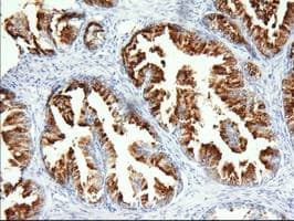 PANK2 Antibody (clone OTI4B3)