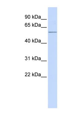 ACVR1C / ALK7 Antibody (aa72-121)