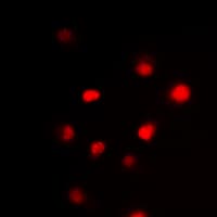 GATA3 Antibody (Internal)