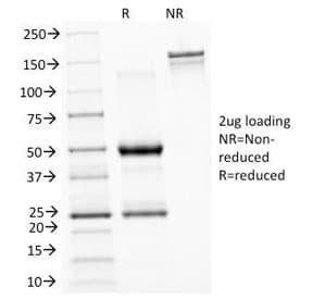 ASRGL1 Antibody (clone CRASH/1289)