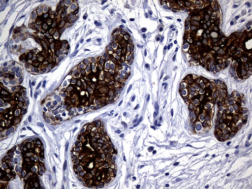 KRT14 / CK14 / Cytokeratin 14 Antibody (aa261-472, clone OTI5F2)
