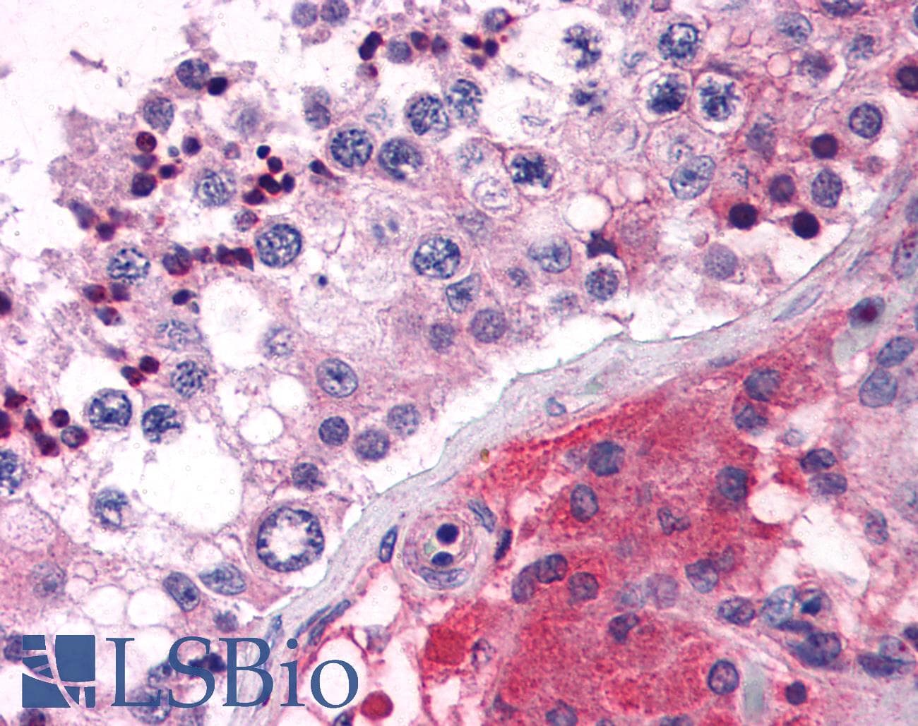 IHC-plus™ Polyclonal Rabbit anti-Human HELO1 / ELOVL5 Antibody (C-Terminus)