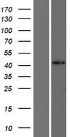 FOXD4L1 / FOXD5 Protein (Over-Expression Lysate Myc-DDK (Flag))