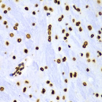 Polyclonal Rabbit anti-Human Histone H3 Antibody (Di-Methyl-Lys4, IHC, IF, WB)