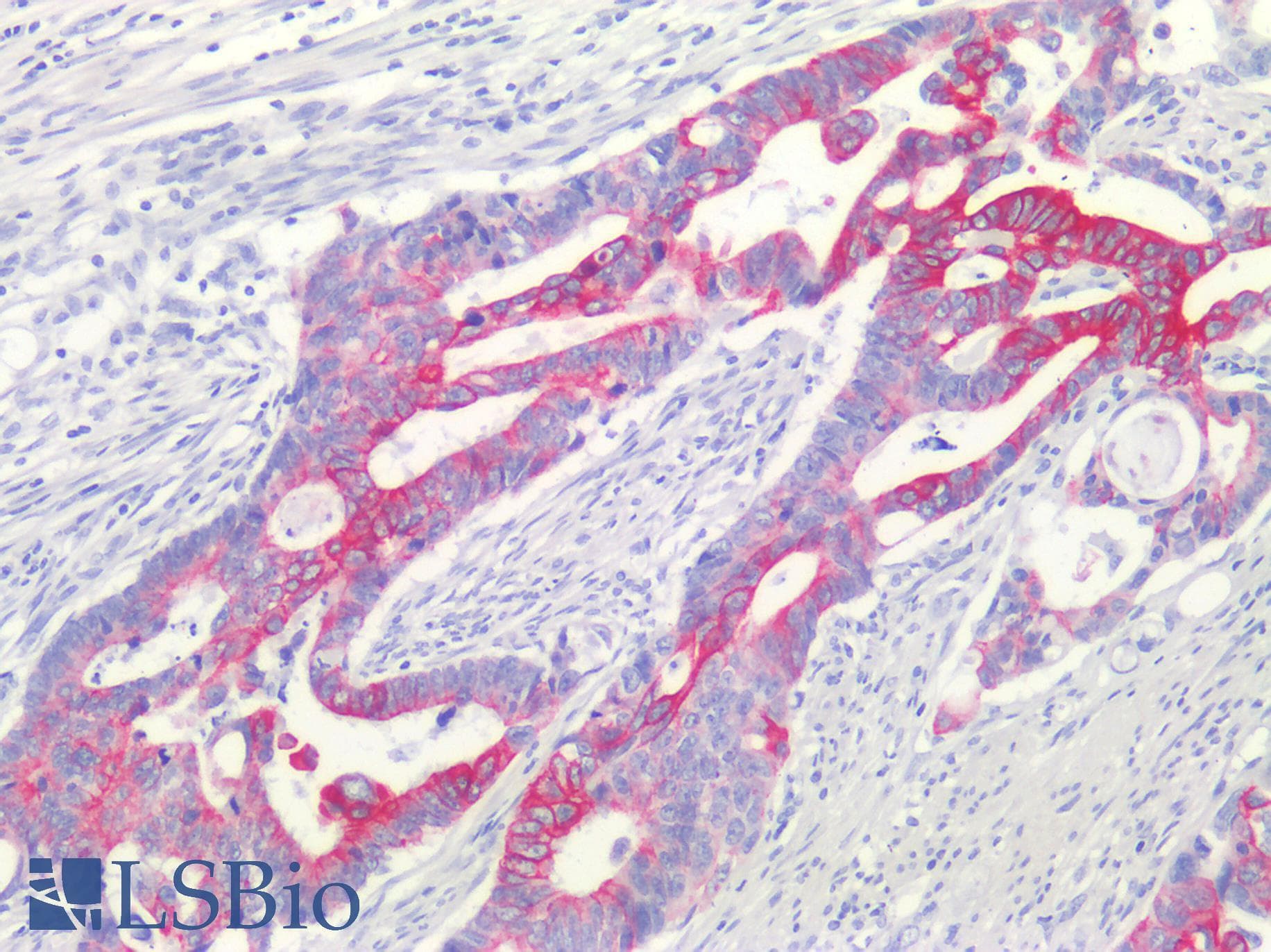 PathPlus™ Monoclonal Mouse anti-Human KRT20 / CK20 / Cytokeratin 20 Antibody (clone Ks20.8, IHC)