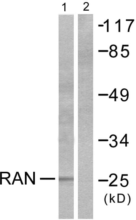 RAN Antibody