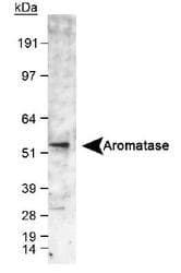 CYP19 / Aromatase Antibody (C-Terminus, DY550)