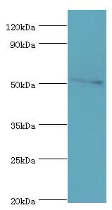 Polyclonal Rabbit anti-Human CHRNA5 Antibody (aa23-240, WB)