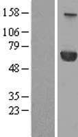 PPM1J Protein (Over-Expression Lysate Myc-DDK (Flag))