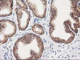 CTNNB1 / Beta Catenin Antibody (clone OTI12H7)