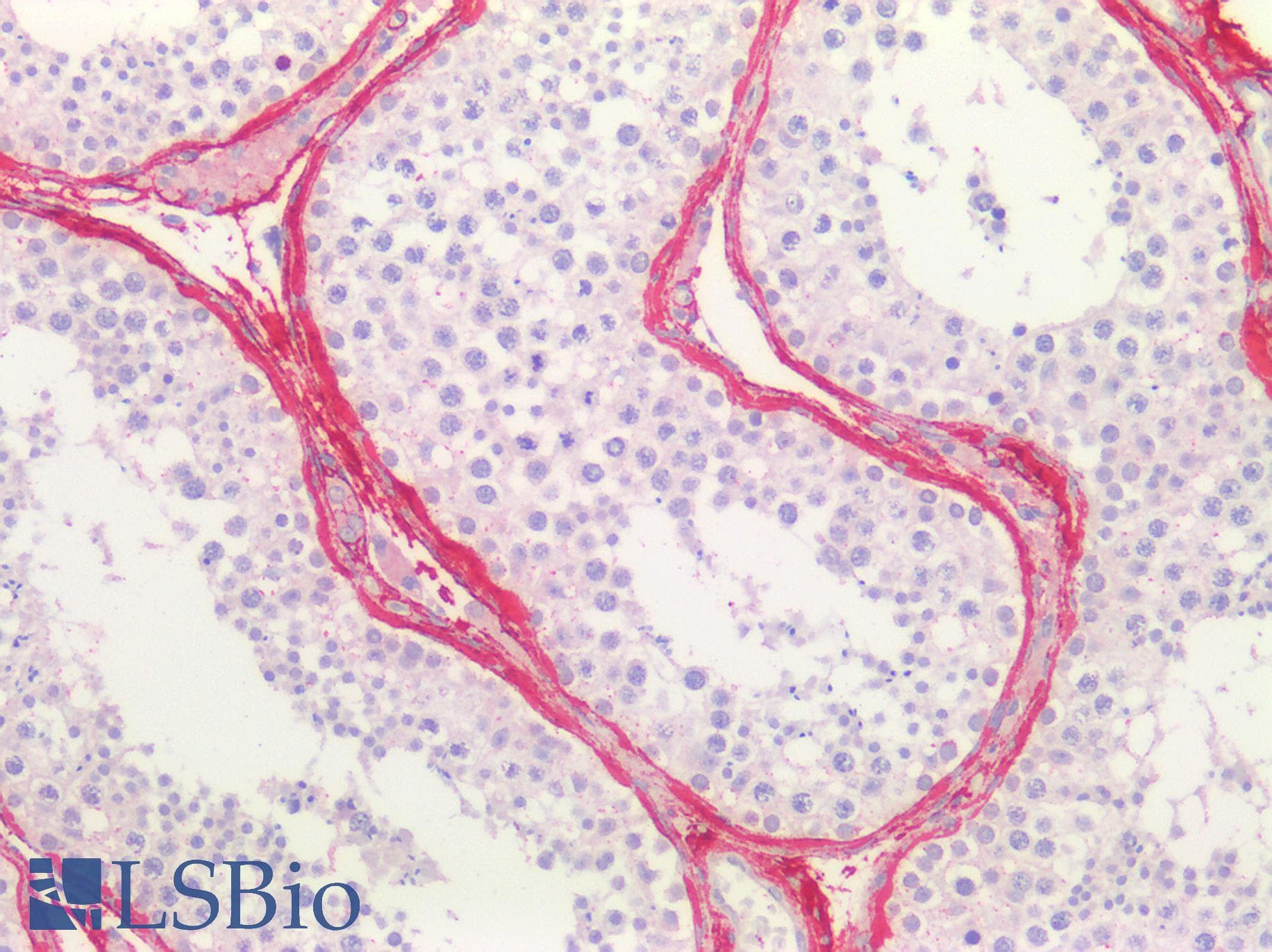 PathPlus™ COL3A1 / Collagen III Antibody