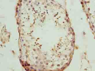 NUP43 Antibody