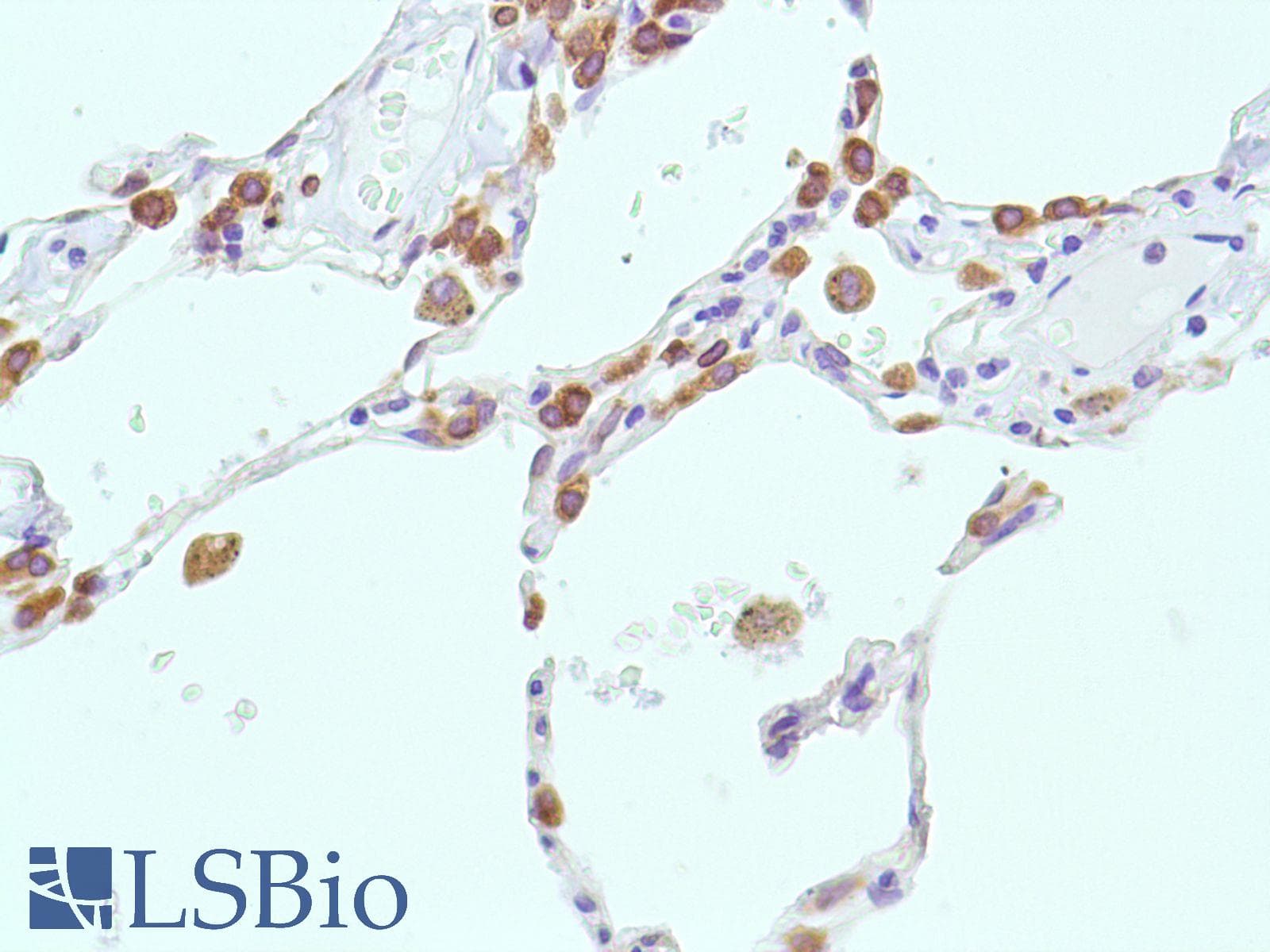 PTGS2 / COX2 / COX-2 Antibody (C-Terminus, clone SP21)