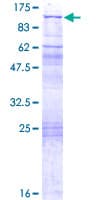 Human GLNRS / QARS Protein (Recombinant GST)