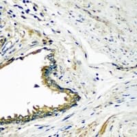 DEFB121 Antibody