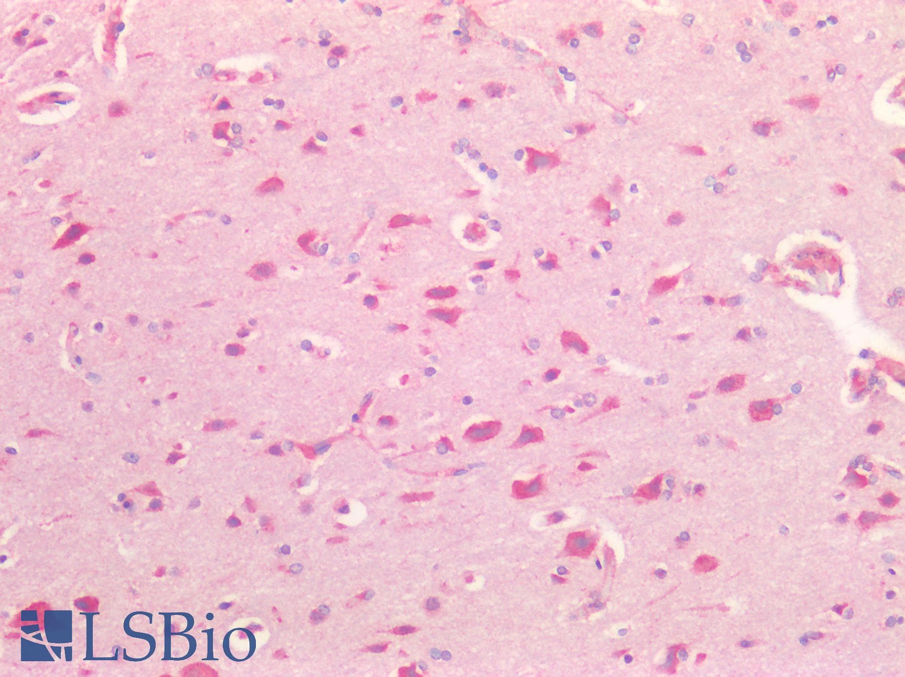 PathPlus™ SORT1 / Sortilin Antibody