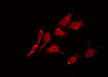 Polyclonal Rabbit anti-Human LTK Antibody (IF, WB)