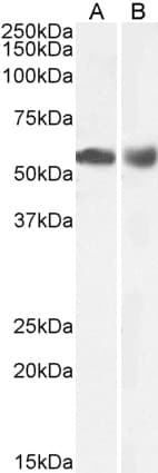 Polyclonal Goat anti-Human HDAC1 Antibody (aa469-480, IF, WB)