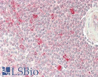 RBPJ Antibody (aa331-380)