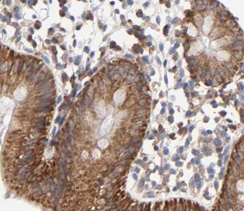 Polyclonal Rabbit anti-Human CYCS / Cytochrome c Antibody (IHC, IF, WB)