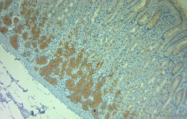 PLDN / Pallidin Antibody (aa50-100)