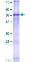 Human SLC35F2 Protein (Recombinant GST)