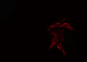 COL4A2 / Collagen IV Alpha2 Antibody
