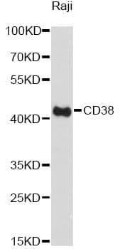 Polyclonal Rabbit anti-Human CD38 Antibody (WB)