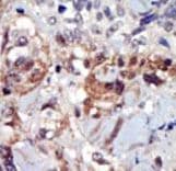 PIP4K2A / PIPK Antibody (aa303-335)