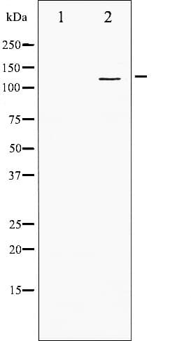 PDGFRA / PDGFR Alpha Antibody