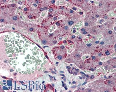 IHC-plus™ INO80 Antibody (aa1506-1556)