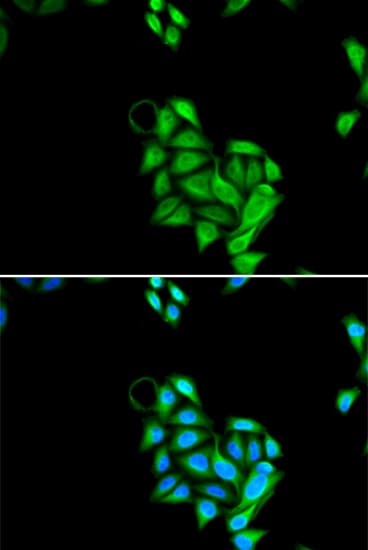 Polyclonal Rabbit anti-Human JADE1 / PHF17 Antibody (IF, WB)